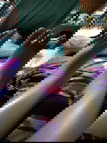 Sakit bengkak kaki setelah melahirkan