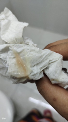 Discaj 38 minggu 2 hari.