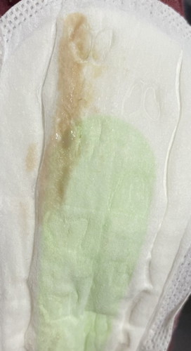 Light brown discharge