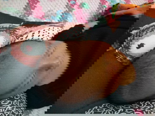 kepala bayi seperti ada bandonya