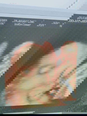 ท้อง6เดือนปวดอวัยเพศและท้องน้อยมาก