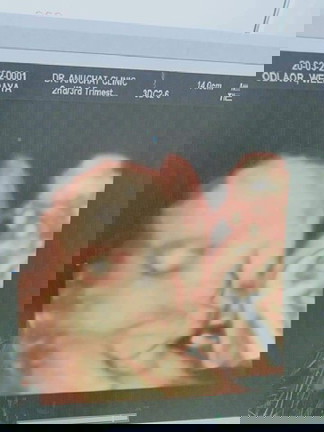 ท้อง6เดือนปวดอวัยเพศและท้องน้อยมาก