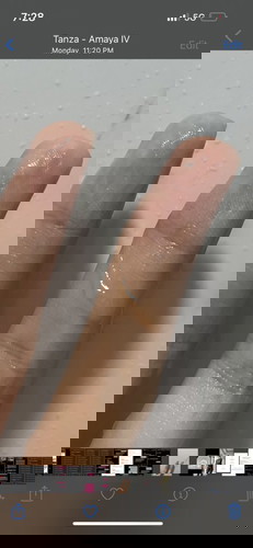 SOFT CERVIX. 7 months pregnant Sino po dito ang biglang soft cervix?