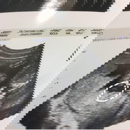 แลกเปลี่ยนความคิดเห็นกันค่ะ