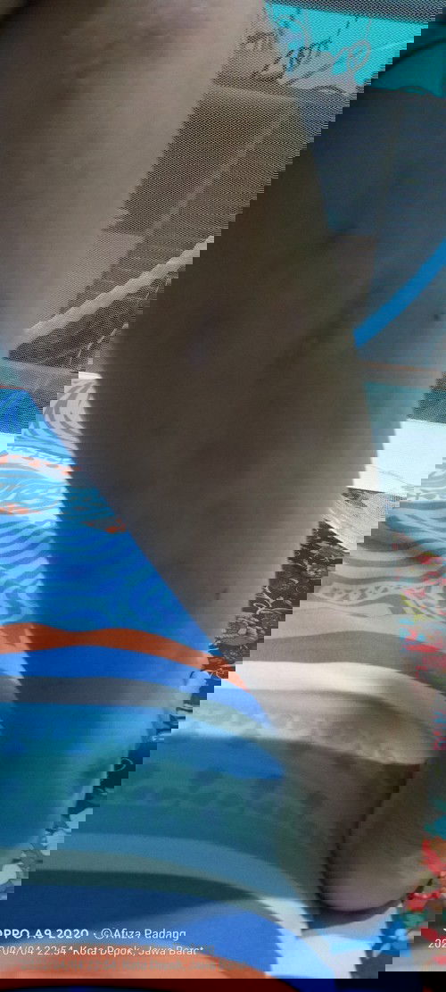 Gatal" habis lahiran sc