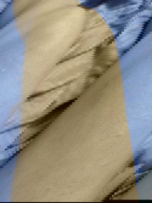 เป็นผื่นคันระหว่างตั้งครรภ์ใครมีวิธีแก้ยังไงบ้างคะขอประสบการณ์หน่อยค่ะ