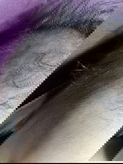 Sa ulo ni baby parang may guhit sa skull nya na at the same time my litid..nagwoworry po ako..first time mom..