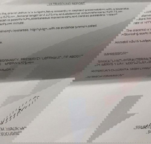 pa help po baka may marunong magbasa mg ultra☺️