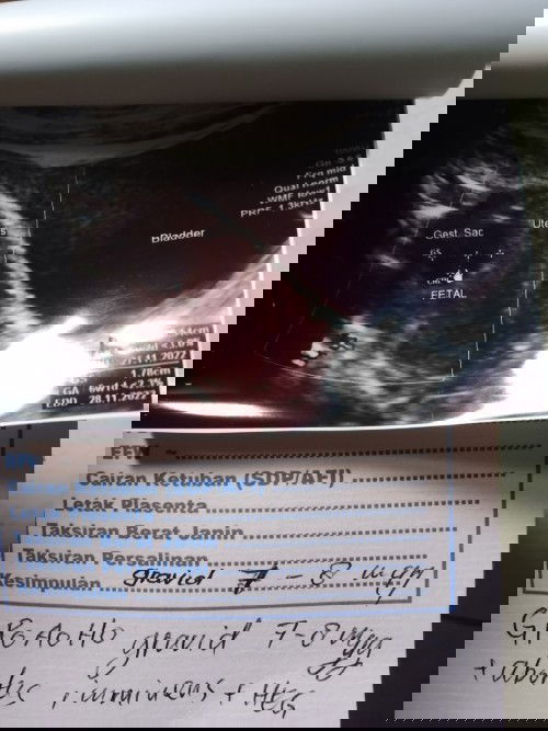 Apakah seperti ini udah ada janin?