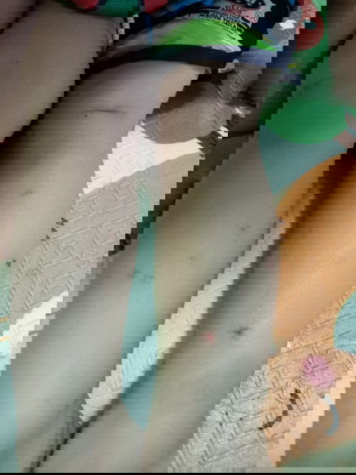 ขอคำแนะนำน้องขาลาย