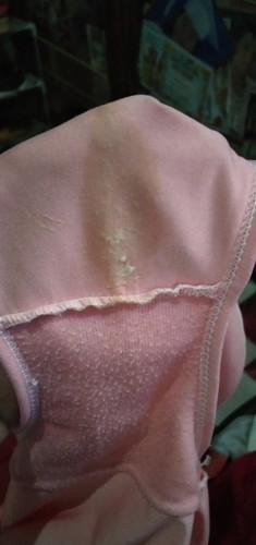 Yeast Infection?