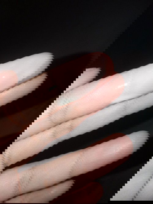 Keluar cairan putih susu