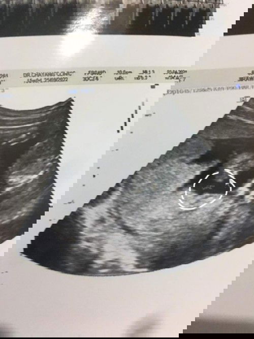 ขอความคิดเห็นแม่ๆหน่อยค่ะ