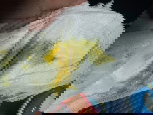 ขออภัยรูปที่ไม่สุภาพนะคะ