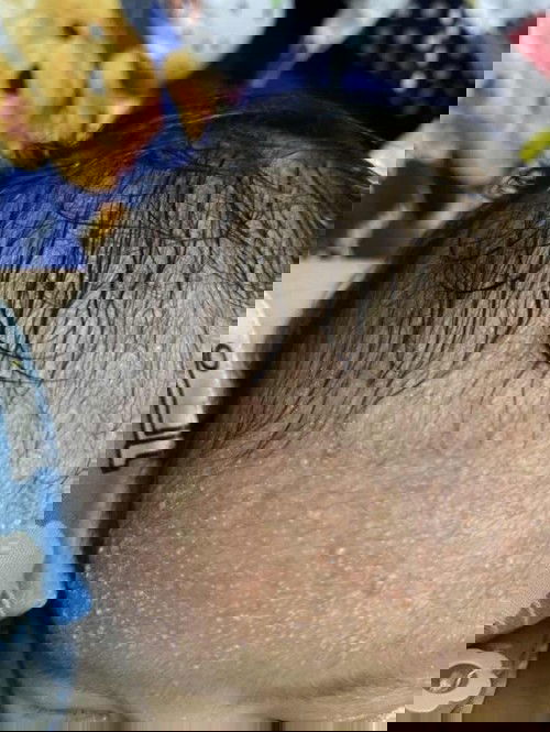 Biang keringat bayi newborn