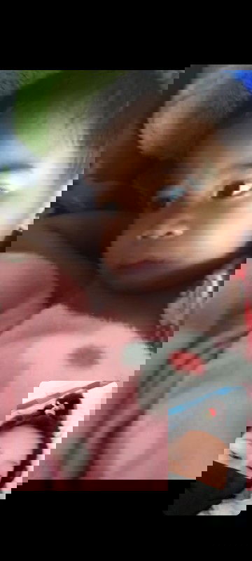 เหงือกบวมปวดฟัน