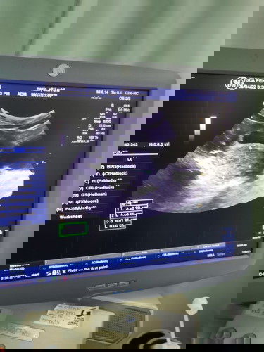 fabroid. 8weeks pregnant