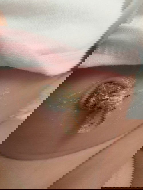 Rốn em bé chưa rụng