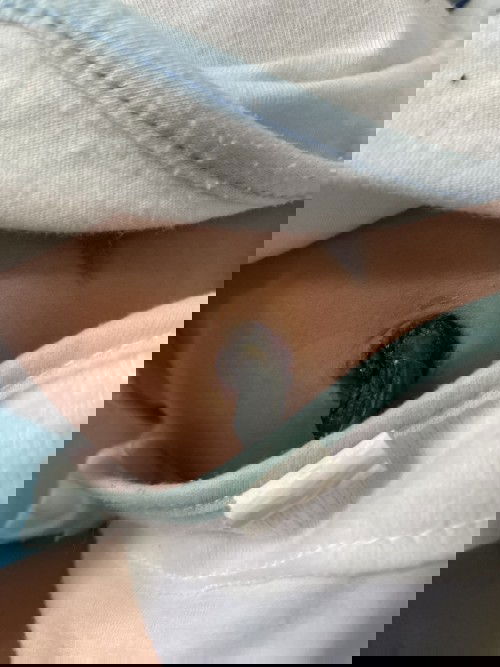 Cuống rốn con có mùi hôi