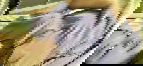 มีเด็กอยากออก เข้า 28wยังไม่ถึงกำหนดเลย ท้องแข็งถี่เกิ๊นนอนไม่ได้ เช้ามามีมูกเลือด ผลที่ได้แอทมิท ให้ยาคลายมดลูก ดีนะที่ปากมดลูกยังไม่เปิด