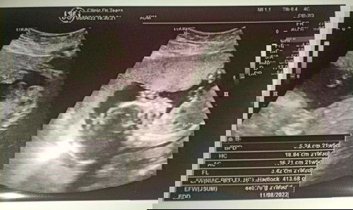 มาอวดลูกๆกันเถอะ