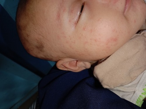 Perkembangan bayi di saat usia 1 bulan