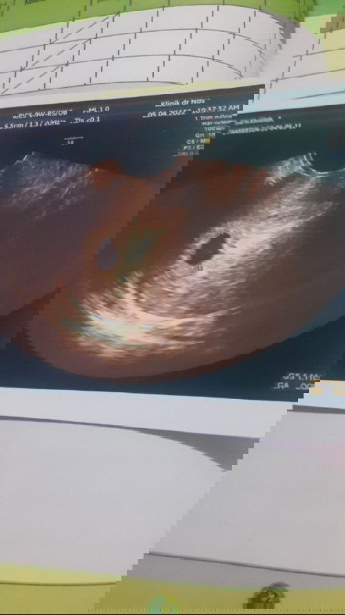 Keluarnya darah dan kecoklatan