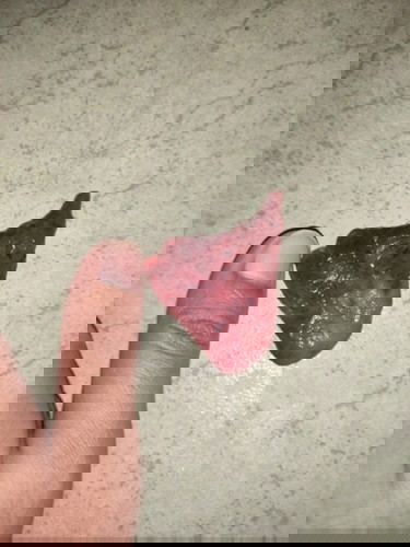 Miscarriage or just mens? Pls help