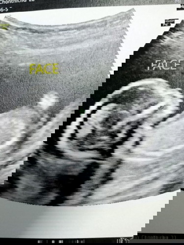 คุณแม่ท้องแรก