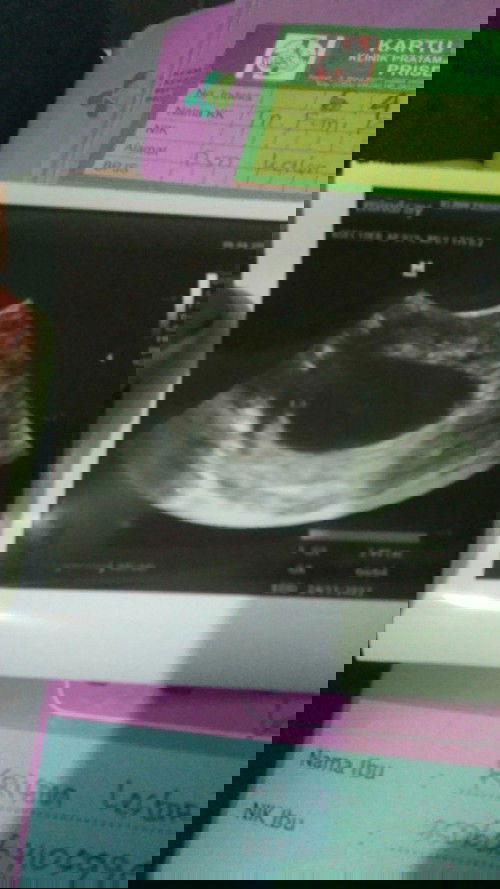 Bunda ada gak yang hamil kosong