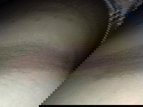 มีแม่ท่านไหนเป็นเหมือนกันมั้ยคะ