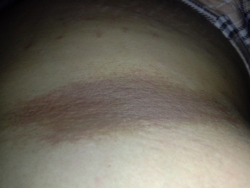 มีแม่ท่านไหนเป็นเหมือนกันมั้ยคะ