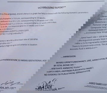 Tanong about sa result