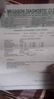 tama bayun mga sis mga april 30 or may pwede na daw aq manganak pero duedate ko is may 10 2022...