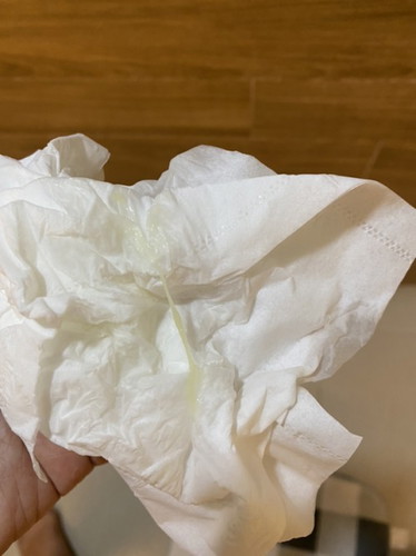 Discharge at 21 weeks