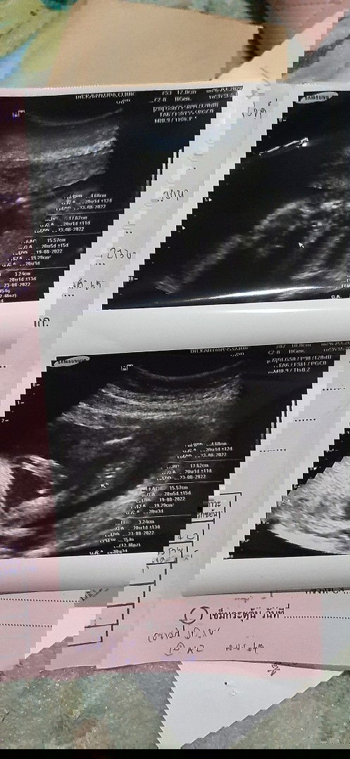 ผู้ชายหรือผู้หญิง