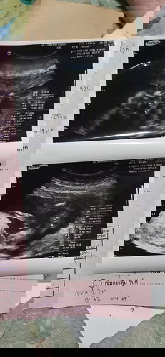 ผู้ชายหรือผู้หญิง