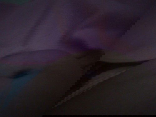 Perut tiba2 kontraksi, tegang, menonjol ke satu sisi dan keras