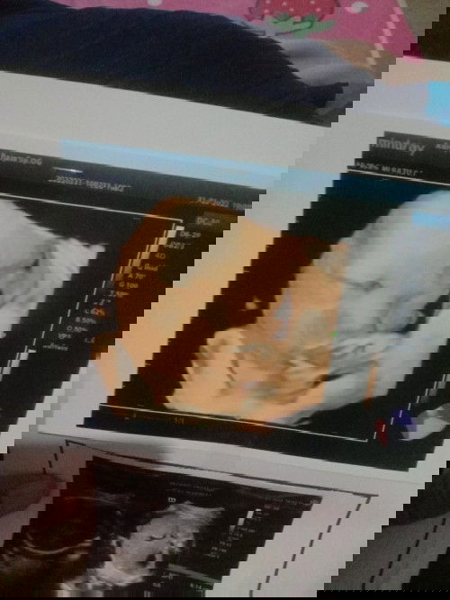 Bbj normal atau tidak