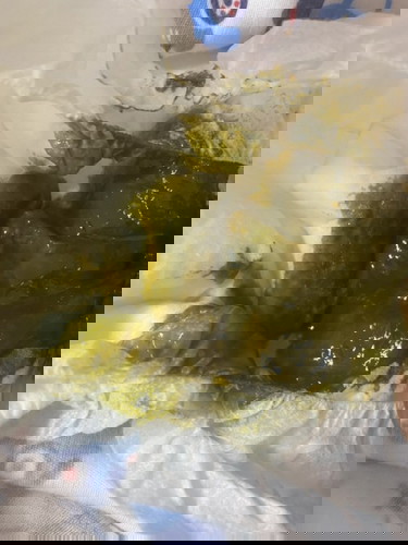 น้อง25วัน ถ่ายแบบนี้ปกติไหมคะ กินนมแม่ปั๊มนมไม่ดูดเต้า