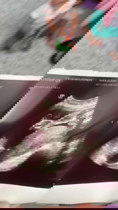 Momyy rase betul ke doktor kate boboy ?