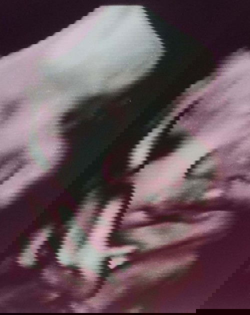 Foto usg Vs foto lahir