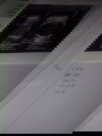 Mohon pencerahan nya...