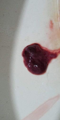 สอบถามหย่อยค่ะพี่ๆ