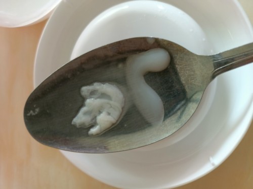 Susu badan berketul?
