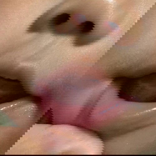 เหงือกน้อง 5 เดือน