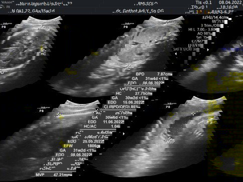 Tips menambah berat badan janjin