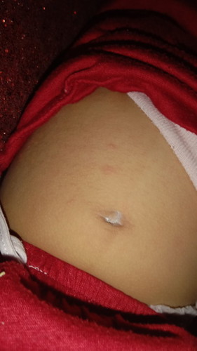 Ada yang pernah ngalamin kah?