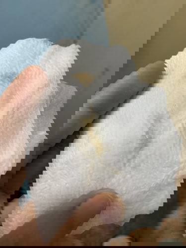 มีมูกแบบนี้ ออกมาปกติมั้ยคะ