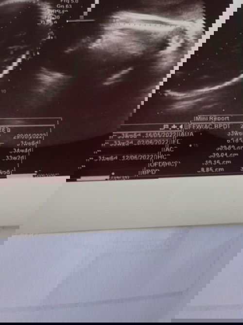 Hasil FL di 2 alat USG, bln skrg lebih rendah dr bln kmrn.